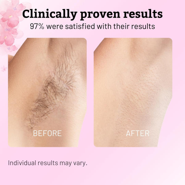 SmoothSkin Botanical Oil